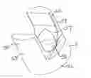 Fig. 01 - Polyaxial bone anchor with insert guides