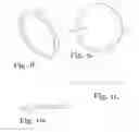 Fig. 04 - Polyaxial bone anchor with insert guides