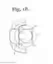 Fig. 07 - Polyaxial bone anchor with insert guides