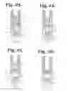 Fig. 09 - Polyaxial bone anchor with insert guides