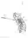 Fig. 12 - Apparatus and devices for percutaneously extending an existing spinal construct