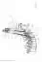 Fig. 19 - Apparatus and devices for percutaneously extending an existing spinal construct