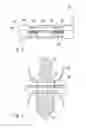 Fig. 03 - Spinal implants and methods