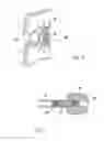 Fig. 04 - Spinal implants and methods