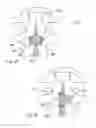 Fig. 16 - Spinal implants and methods