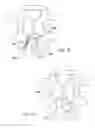 Fig. 17 - Spinal implants and methods