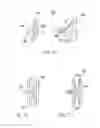Fig. 22 - Spinal implants and methods