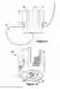 Fig. 03 - Tether clamp and implantation system