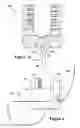 Fig. 04 - Tether clamp and implantation system