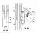 Fig. 22 - Tether clamp and implantation system