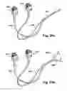 Fig. 24 - Tether clamp and implantation system