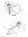 Fig. 25 - Tether clamp and implantation system