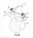 Fig. 27 - Tether clamp and implantation system