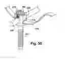 Fig. 29 - Tether clamp and implantation system