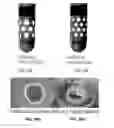 Fig. 23 - Method and system for consistent, repeatable, and safe cryospray treatment of airway tissue