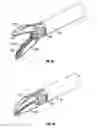 Fig. 05 - Endoscopic vessel sealer and divider for large tissue structures