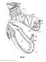 Fig. 12 - Endoscopic vessel sealer and divider for large tissue structures