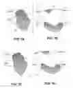 Fig. 09 - Body structure imaging