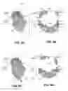 Fig. 11 - Body structure imaging