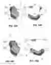 Fig. 12 - Body structure imaging