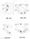 Fig. 13 - Body structure imaging