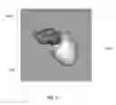 Fig. 15 - Body structure imaging
