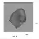 Fig. 17 - Body structure imaging