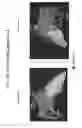 Fig. 18 - Body structure imaging