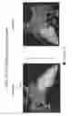Fig. 19 - Body structure imaging