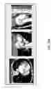 Fig. 28 - Body structure imaging