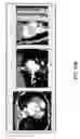 Fig. 29 - Body structure imaging