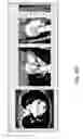 Fig. 30 - Body structure imaging
