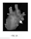Fig. 33 - Body structure imaging
