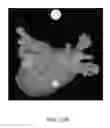 Fig. 35 - Body structure imaging