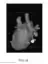 Fig. 41 - Body structure imaging