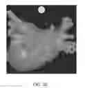 Fig. 44 - Body structure imaging