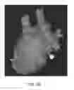 Fig. 45 - Body structure imaging