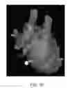 Fig. 48 - Body structure imaging