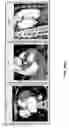 Fig. 56 - Body structure imaging