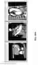Fig. 58 - Body structure imaging