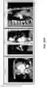 Fig. 59 - Body structure imaging