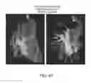 Fig. 61 - Body structure imaging