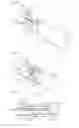Fig. 09 - Catheter for denervation