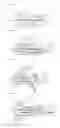 Fig. 11 - Catheter for denervation