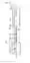 Fig. 15 - Catheter for denervation