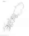 Fig. 25 - Catheter for denervation