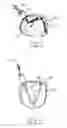 Fig. 08 - Apparatus and method for intra-cardiac mapping and ablation