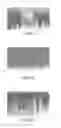 Fig. 10 - APPARATUS AND METHOD FOR PRODUCING VERY SMALL MICROCHANNELS IN TISSUE