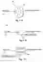 Fig. 14 - SYSTEM AND METHOD FOR MICROABLATION OF TISSUE