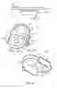 Fig. 12 - Surgical system